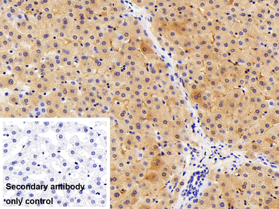 Polyclonal Antibody to Neutrophil gelatinase-associated lipocalin (NGAL)