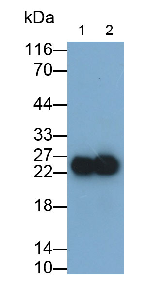 Polyclonal Antibody to Neutrophil gelatinase-associated lipocalin (NGAL)