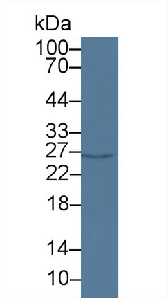 Polyclonal Antibody to Platelet Activating Factor Acetylhydrolase Ib3 (PAFAH1B3)