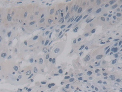 Polyclonal Antibody to Protease, Serine 12 (PRSS12)