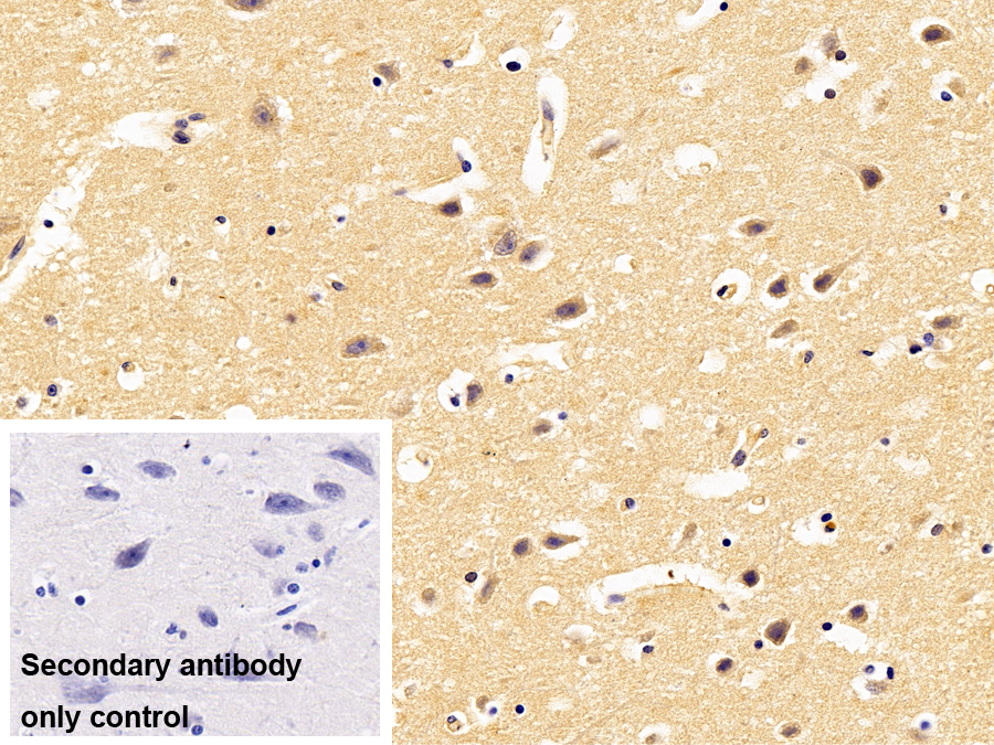 Polyclonal Antibody to Protocadherin Beta 2 (PCDHb2)