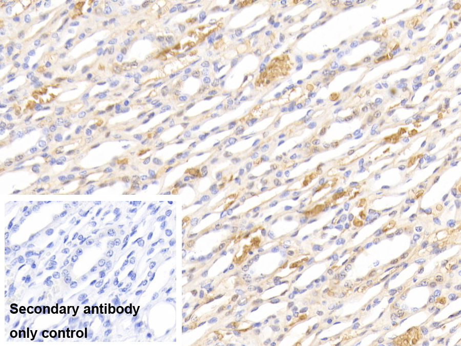 Polyclonal Antibody to Hemoglobin (HB)