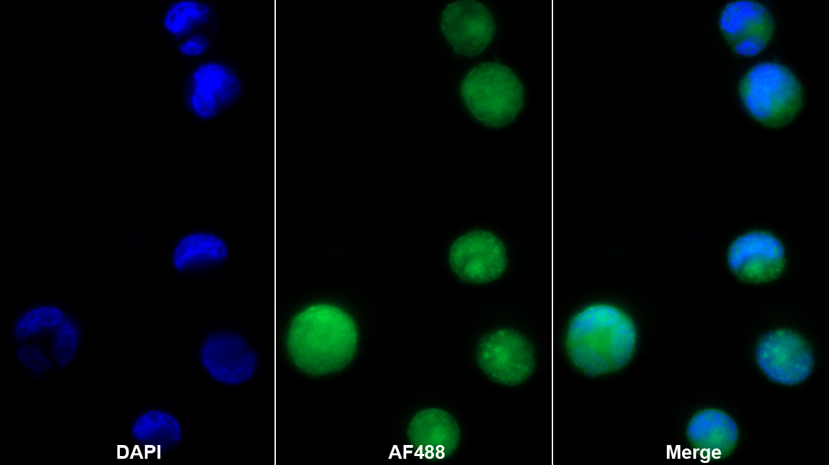 Polyclonal Antibody to Hemoglobin (HB)