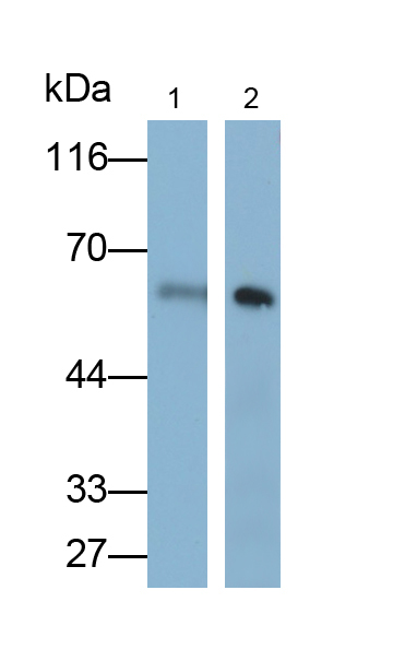 Polyclonal Antibody to Interferon Alpha/Beta Receptor 1 (IFNa/bR1)