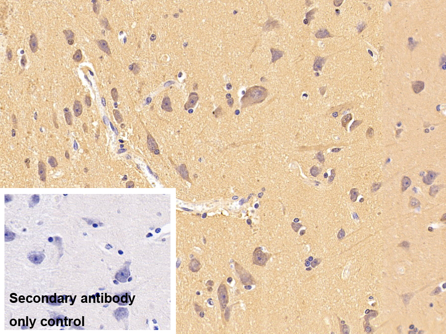 Polyclonal Antibody to Enolase 3 (ENO3)