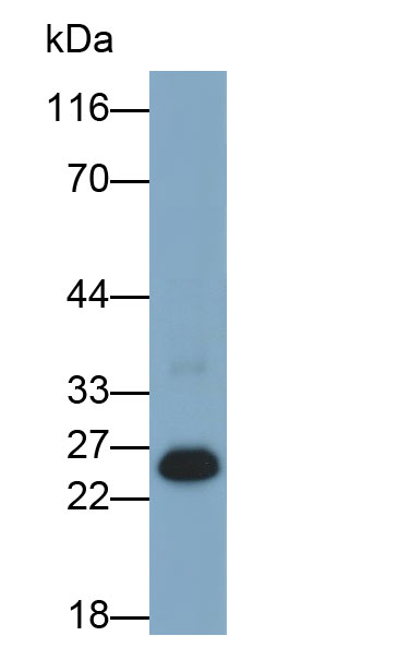 Polyclonal Antibody to Proteinase 3 (PR3)