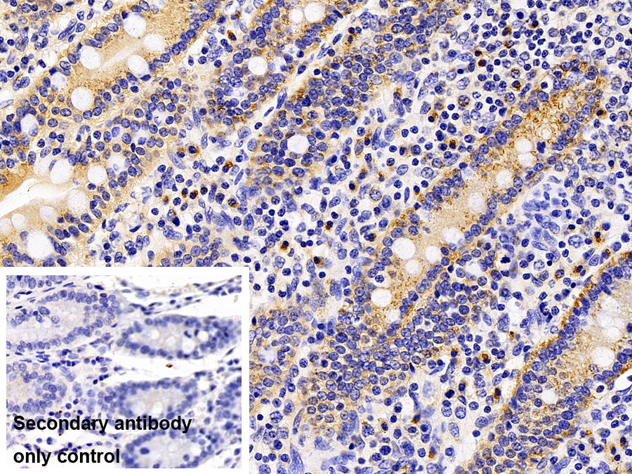 Polyclonal Antibody to Lysosomal Associated Membrane Protein 1 (LAMP1)