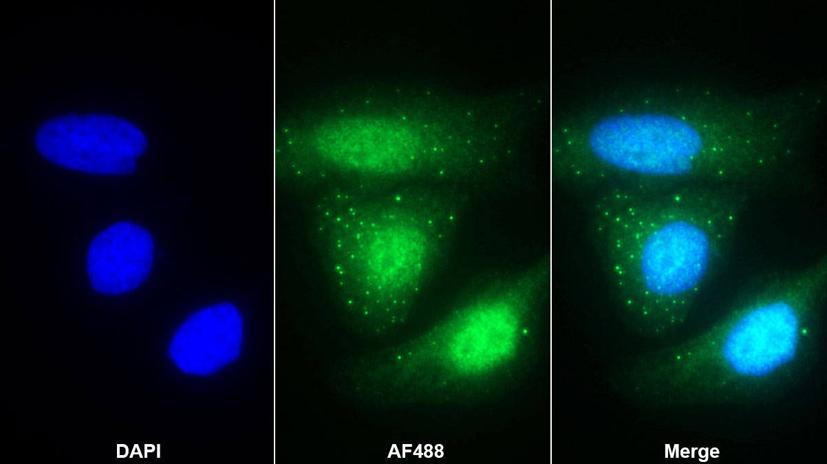 Polyclonal Antibody to Early Growth Response Protein 3 (EGR3)