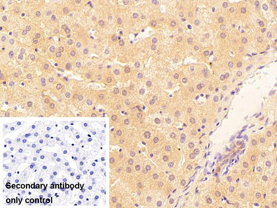 Polyclonal Antibody to Acetylcholinesterase (ACHE)