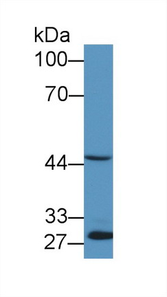 Polyclonal Antibody to Early Growth Response Protein 2 (EGR2)