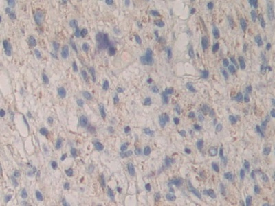 Polyclonal Antibody to MAP Kinase Activated Protein Kinase 2 (MAPKAPK2)