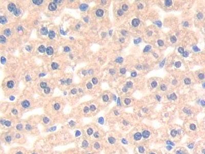 Polyclonal Antibody to Poliovirus Receptor Related Protein 3 (PVRL3)