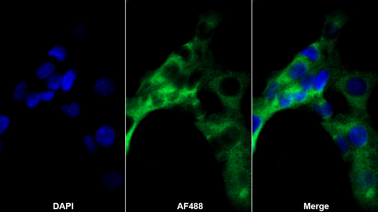 Polyclonal Antibody to Mannose Binding Lectin (MBL)