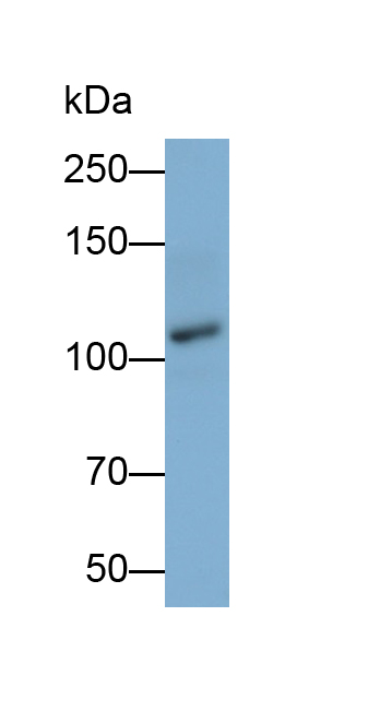 Polyclonal Antibody to N-cadherin (NCAD)