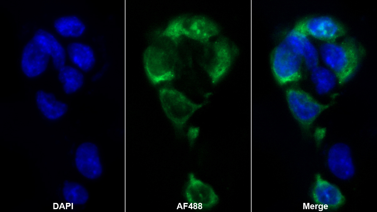 Polyclonal Antibody to N-cadherin (NCAD)