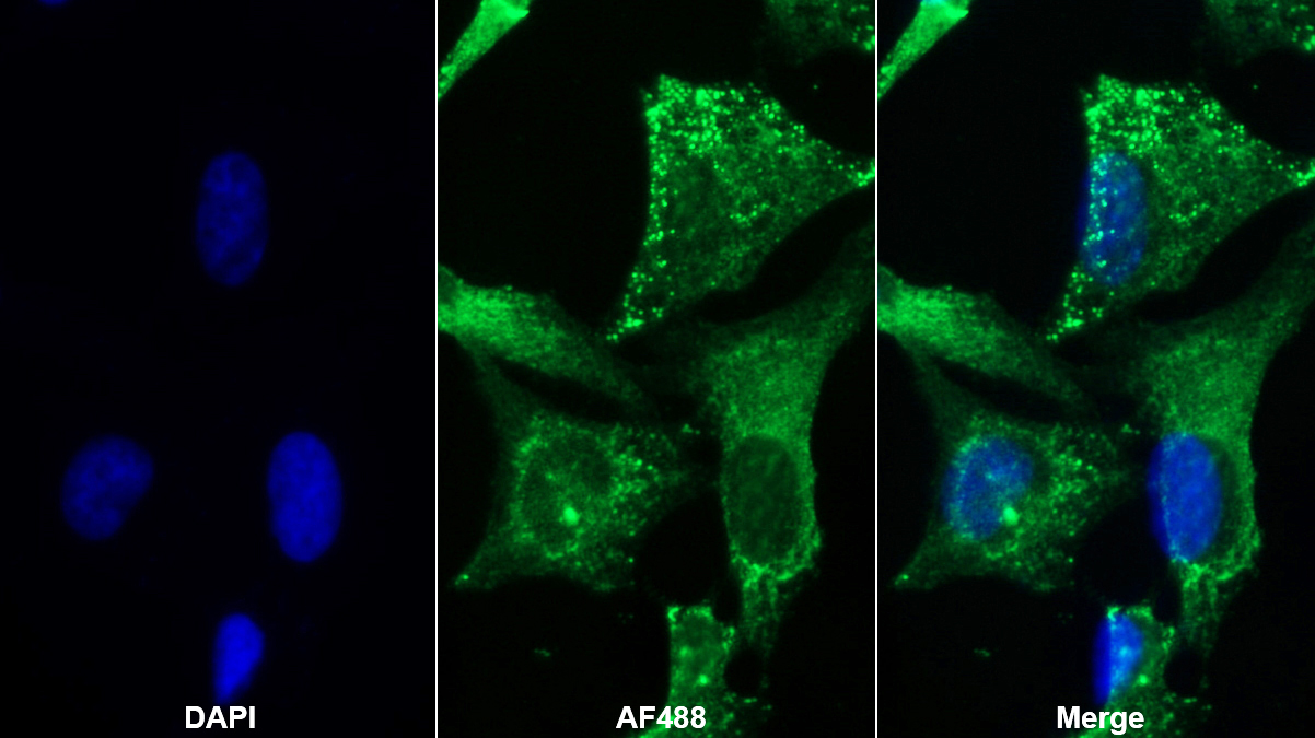 Polyclonal Antibody to Protein Disulfide Isomerase (PDI)