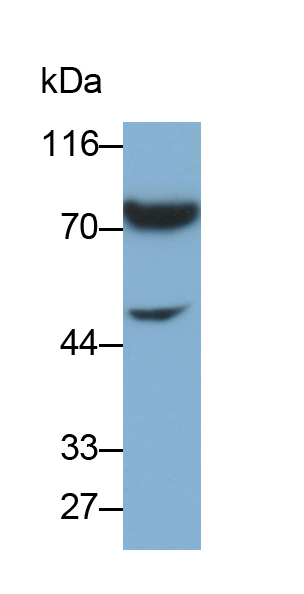 Polyclonal Antibody to Tumor Necrosis Factor Receptor 1 (TNFR1)