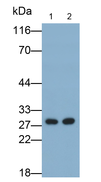 Polyclonal Antibody to Serum Amyloid P Component (SAP)