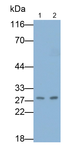 Polyclonal Antibody to Serum Amyloid P Component (SAP)