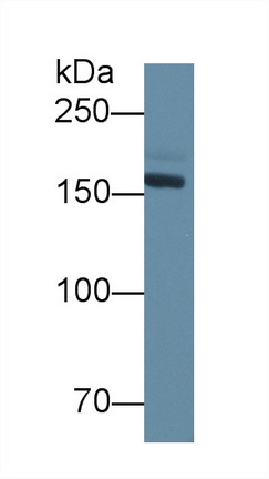 Polyclonal Antibody to Density Enhanced Phosphatase 1 (DEP1)