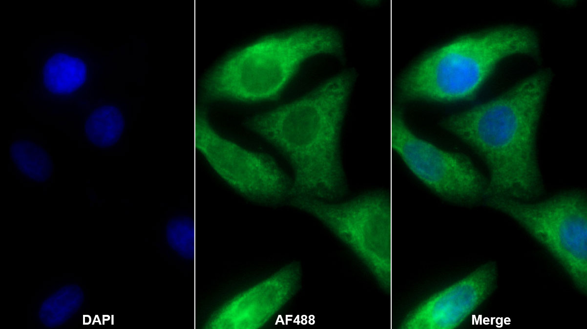 Polyclonal Antibody to Indoleamine-2,3-Dioxygenase (IDO)