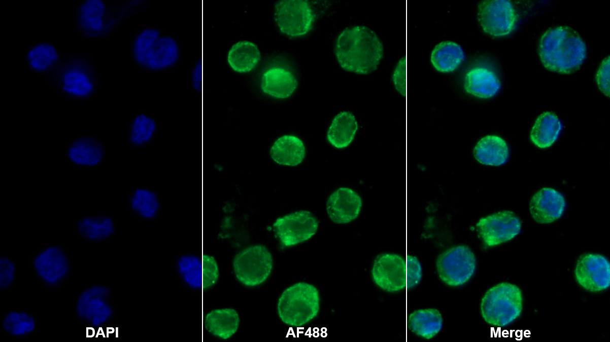 Polyclonal Antibody to Bone Marrow Stromal Cell Antigen 1 (BST1)