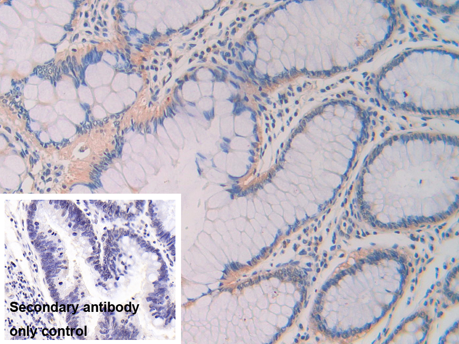 Polyclonal Antibody to Z-DNA Binding Protein 1 (ZBP1)