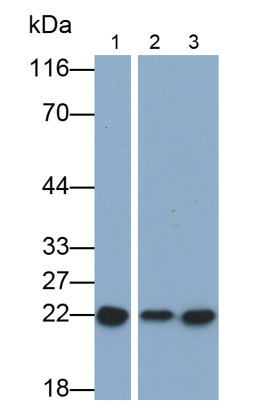 Polyclonal Antibody to Large Multifunctional Peptidase 7 (LMP7)