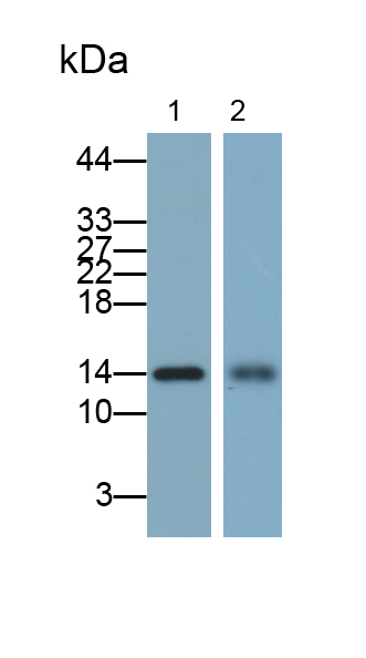 Polyclonal Antibody to Fatty Acid Binding Protein 1 (FABP1)