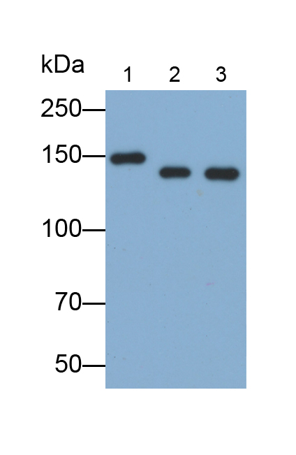 Polyclonal Antibody to Lymphocyte Function Associated Antigen 1 Alpha (CD11a)
