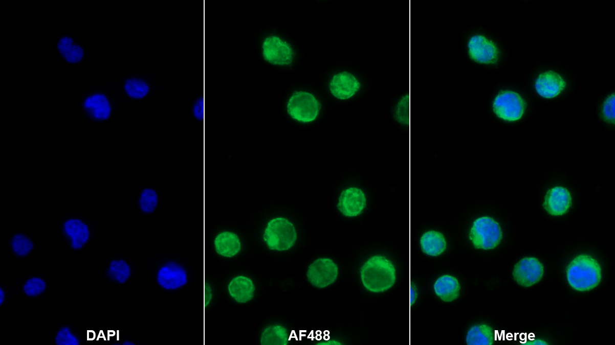 Polyclonal Antibody to Lymphocyte Function Associated Antigen 1 Alpha (CD11a)