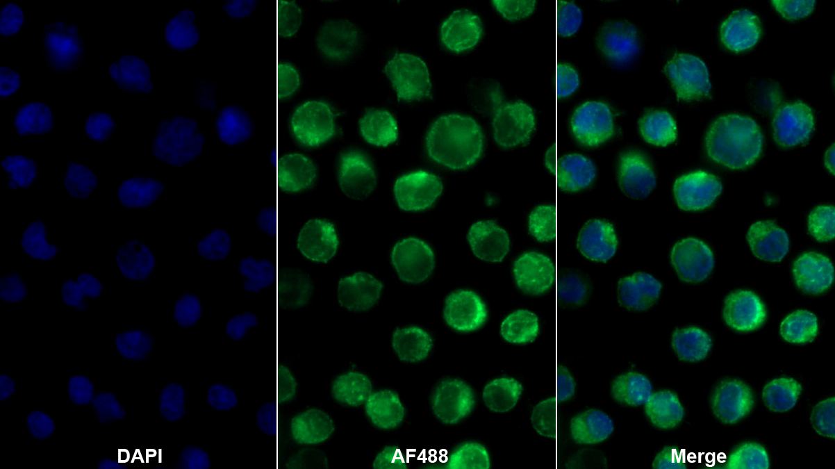 Polyclonal Antibody to Cluster Of Differentiation 2 (CD2)