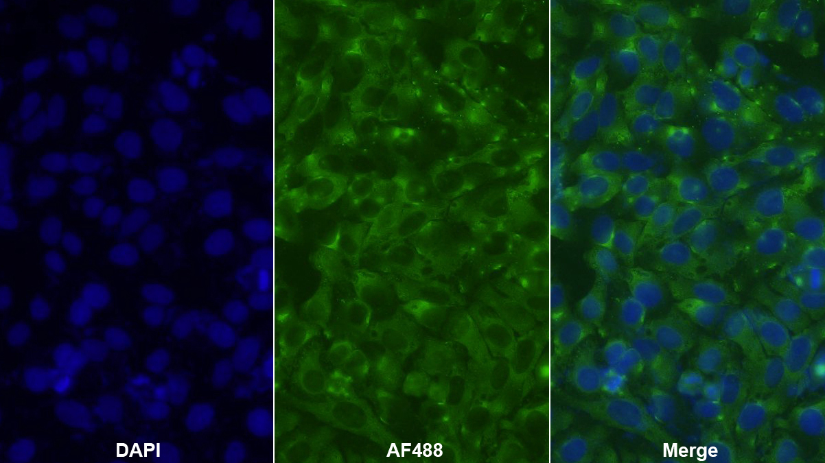 Polyclonal Antibody to Thymosin Beta 4 (TMSB4X)