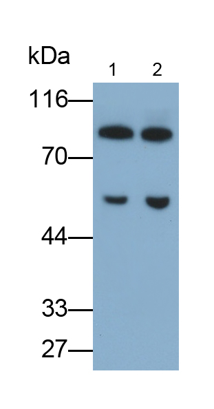 Polyclonal Antibody to Coagulation Factor XIII B Polypeptide (F13B)
