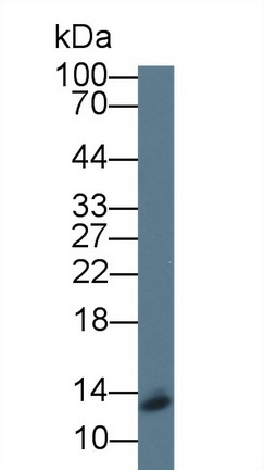 Polyclonal Antibody to Signal Recognition Particle 9kDa (SRP9)