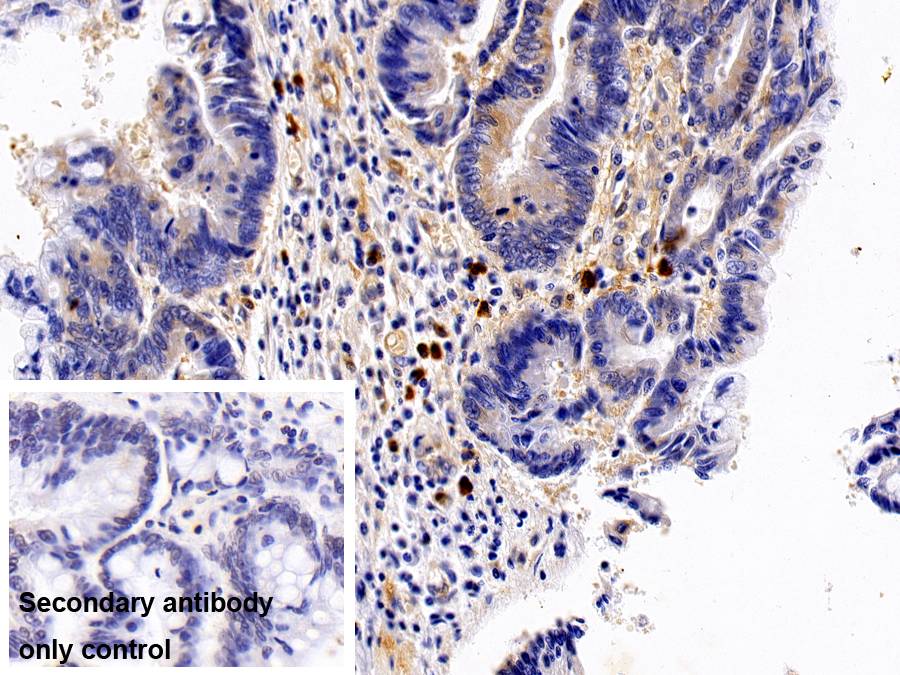 Polyclonal Antibody to Interleukin 13 Receptor Alpha 1 (IL13Ra1)