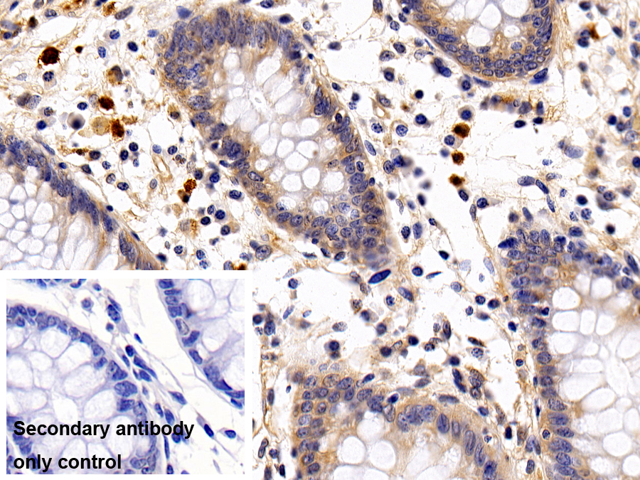 Polyclonal Antibody to Interleukin 13 Receptor Alpha 1 (IL13Ra1)