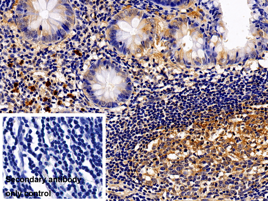 Polyclonal Antibody to Interleukin 13 Receptor Alpha 1 (IL13Ra1)