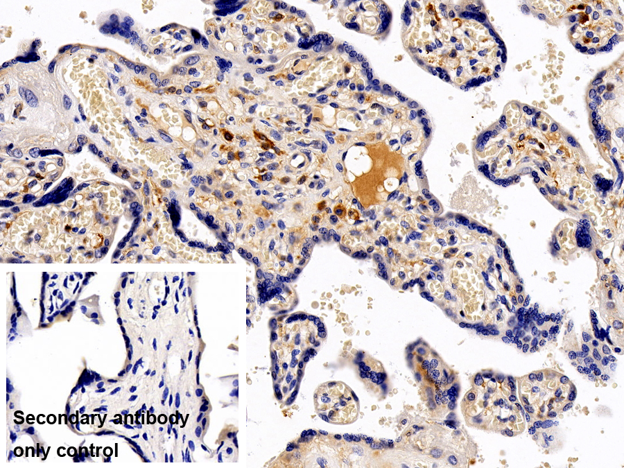 Polyclonal Antibody to Interleukin 13 Receptor Alpha 1 (IL13Ra1)