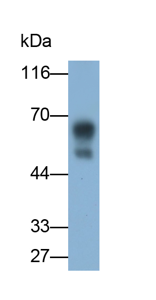 Polyclonal Antibody to Interleukin 13 Receptor Alpha 2 (IL13Ra2)
