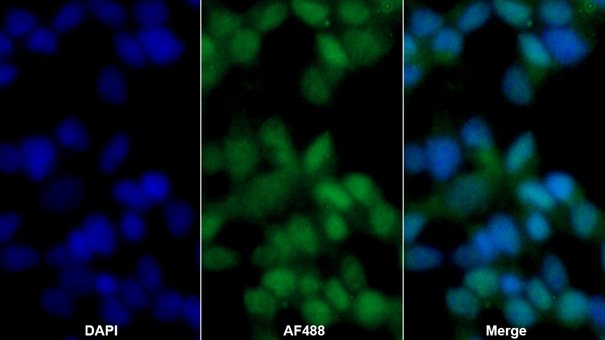 Polyclonal Antibody to Phosphoglycerate Mutase 2, Muscle (PGAM2)
