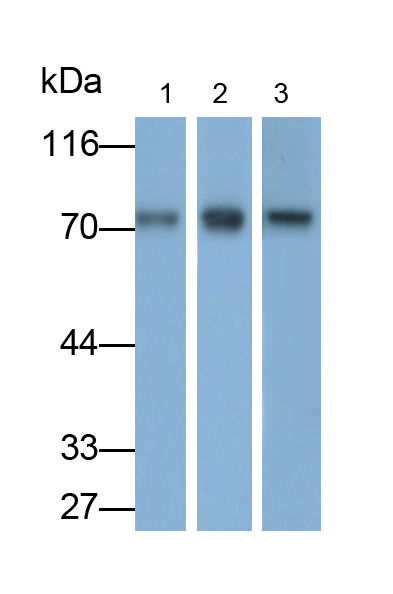 Polyclonal Antibody to Solute Carrier Family 27 Member 5 (SLC27A5)