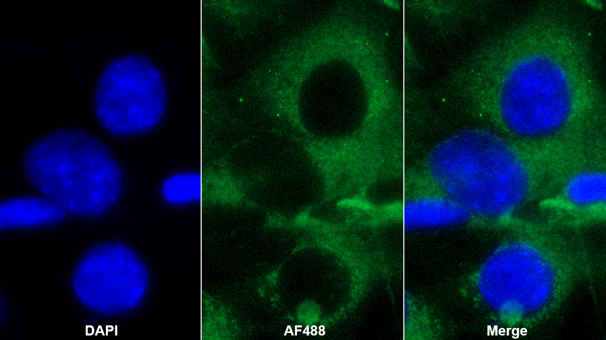 Polyclonal Antibody to Solute Carrier Family 27 Member 5 (SLC27A5)