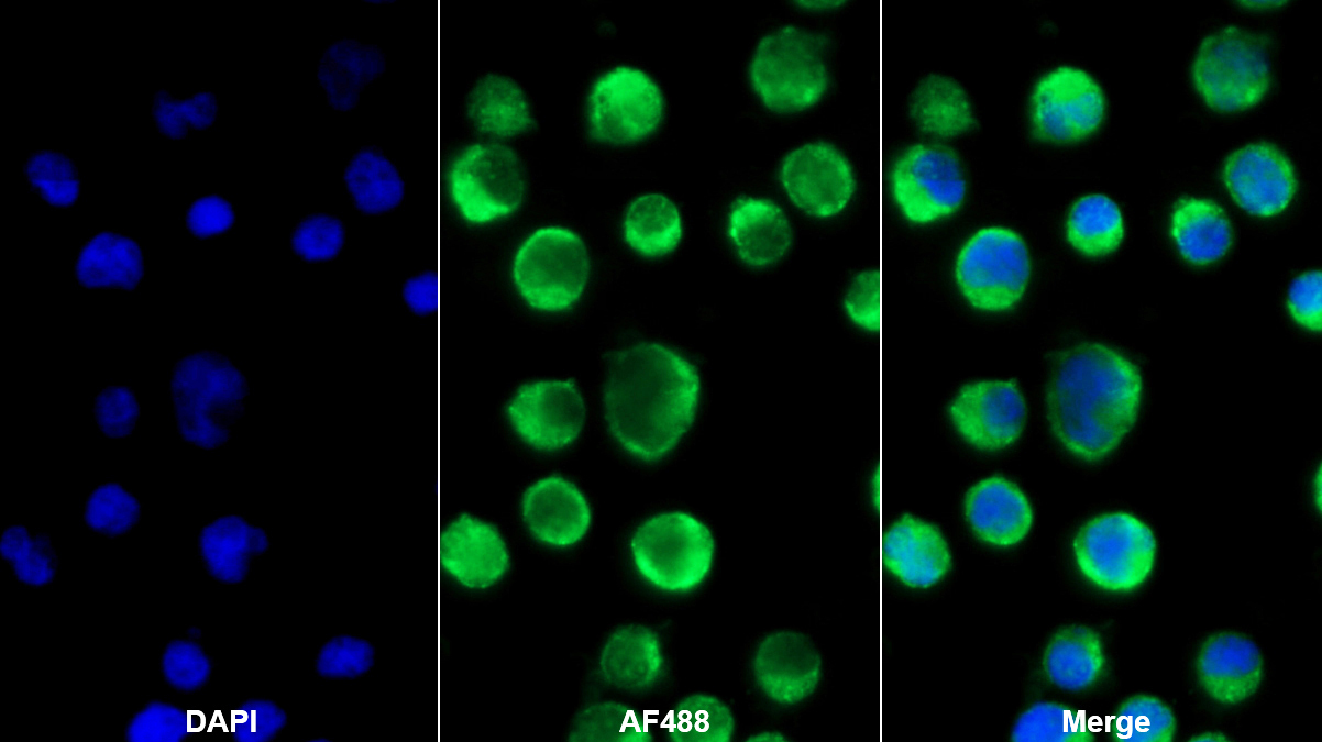 Polyclonal Antibody to Cluster Of Differentiation 226 (CD226)