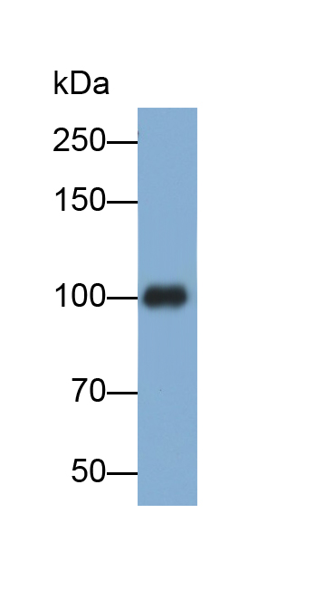 Polyclonal Antibody to Cluster Of Differentiation 146 (CD146)