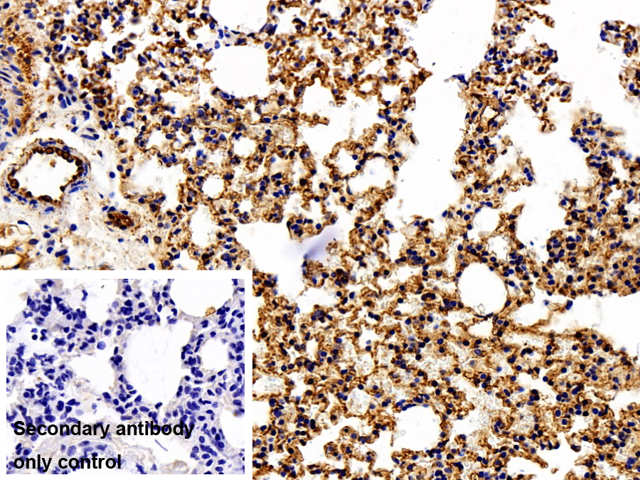 Polyclonal Antibody to Cluster Of Differentiation 146 (CD146)