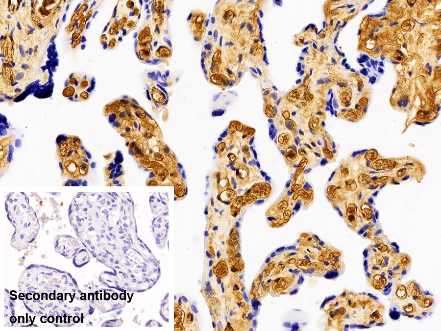 Polyclonal Antibody to Immunoglobulin G2 (IgG2)