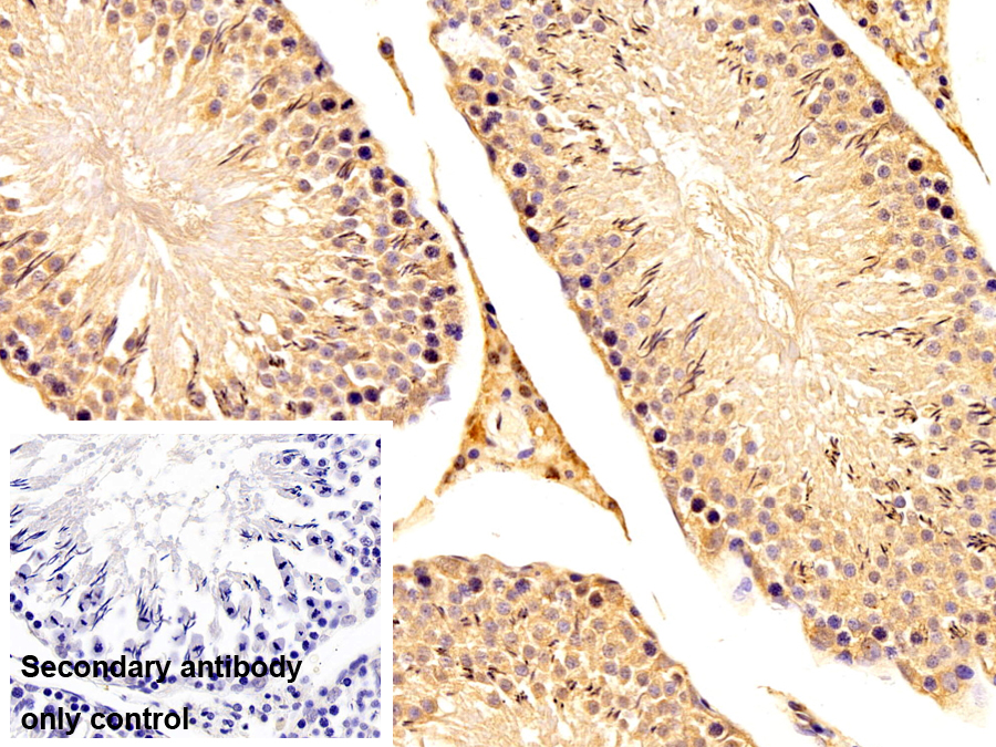 Polyclonal Antibody to Myogenic Differentiation (MyoD)