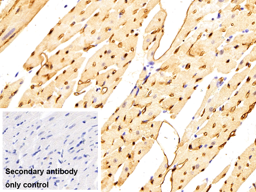 Polyclonal Antibody to Fatty Acid Binding Protein 4 (FABP4)