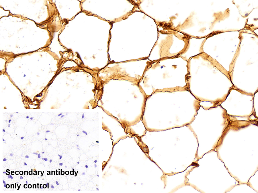 Polyclonal Antibody to Fatty Acid Binding Protein 4 (FABP4)